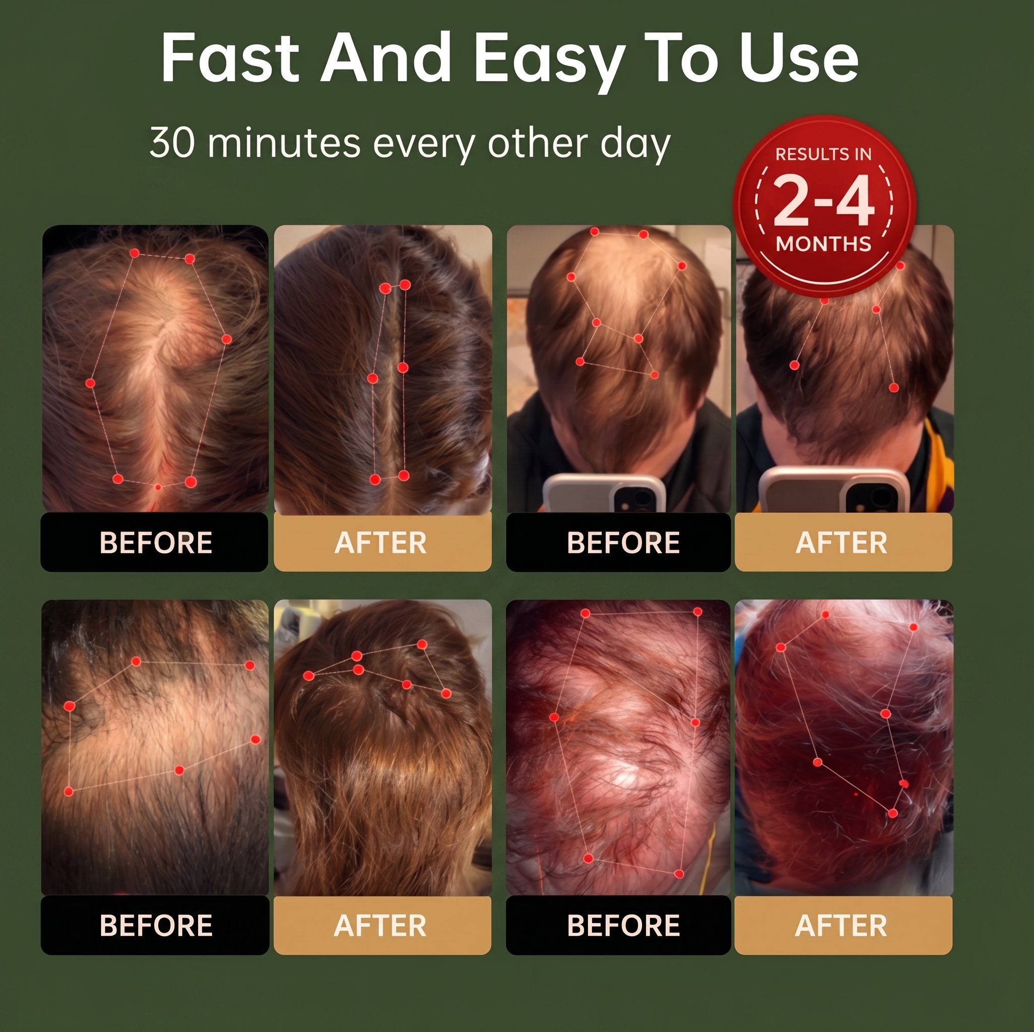 Red Light Therapy Regrowth Cap